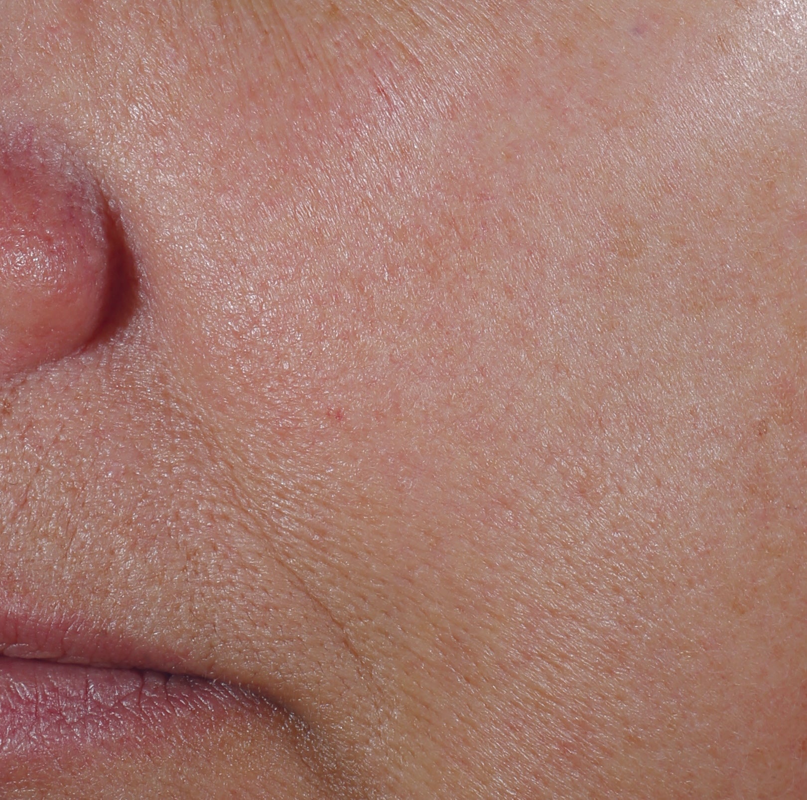 The Power of Synergy: Revox™ Line Relaxer + Neuromodulator