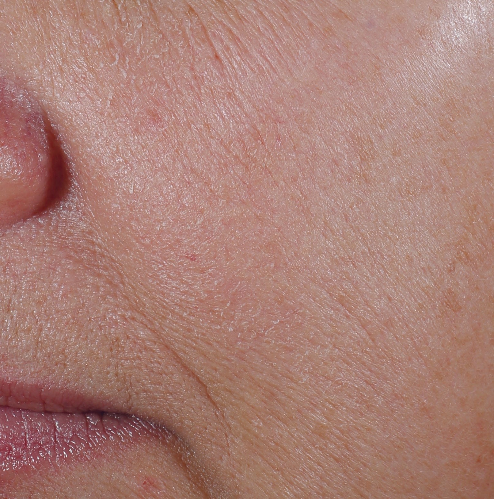 The Power of Synergy: Revox™ Line Relaxer + Neuromodulator