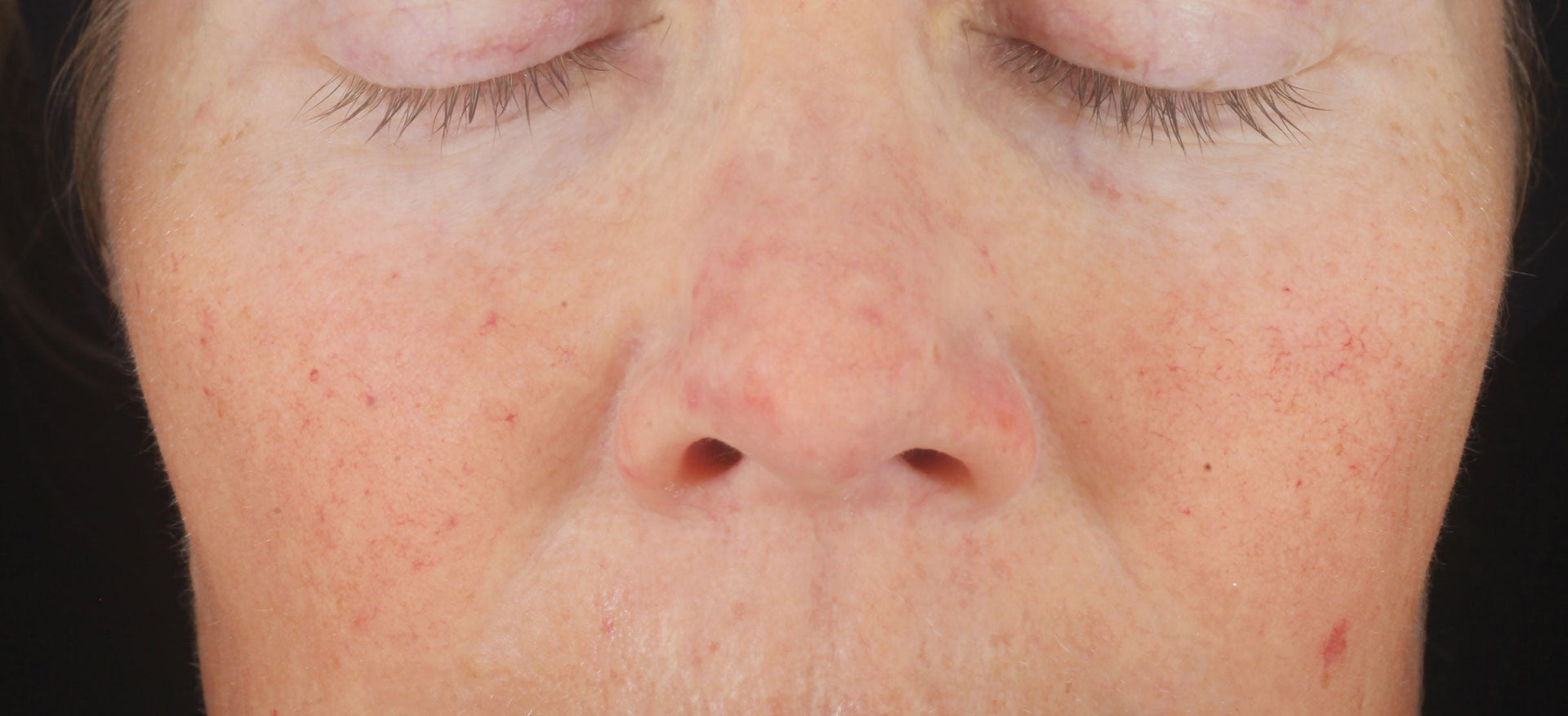 A comprehensive eye treatment inspired by the Dermal-Epidermal Junction(DEJ) that is clinically-proven to rejuvenate the total eye area