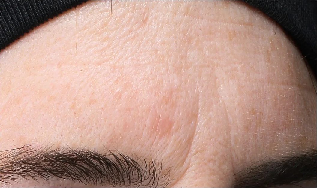 The Power of Revox™ Line Relaxer