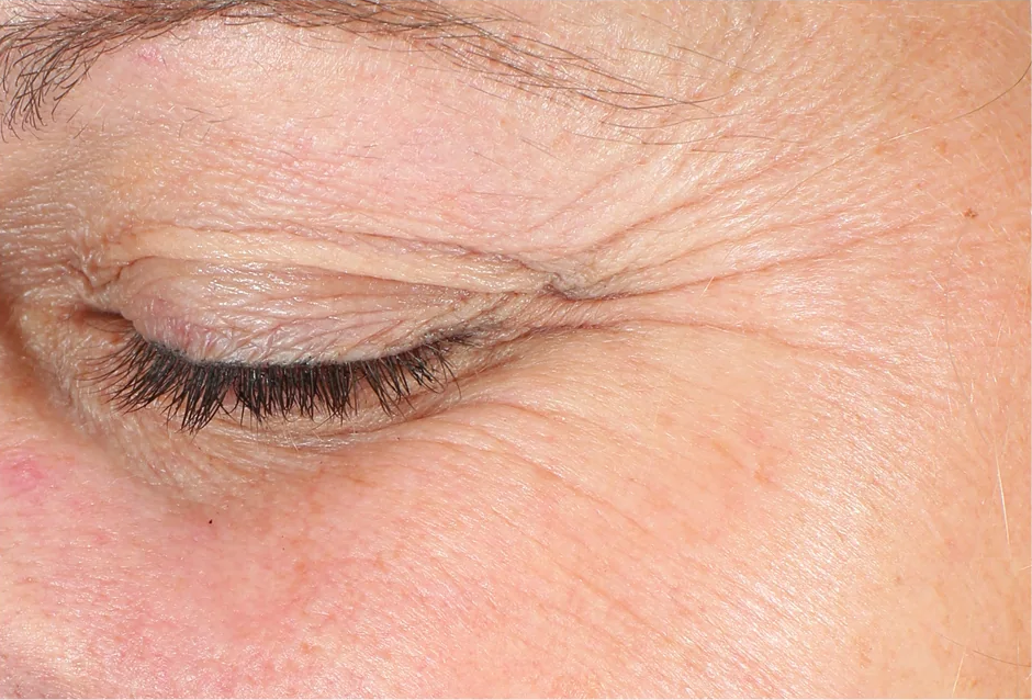 The Power of Synergy: Revox™ Line Relaxer + Neuromodulator