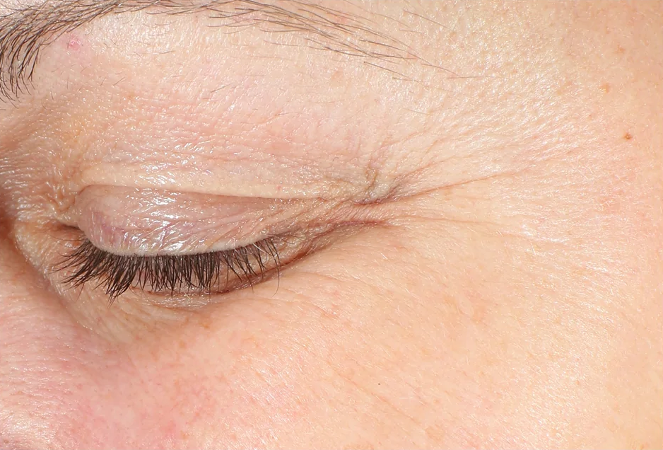 The Power of Synergy: Revox™ Line Relaxer + Neuromodulator