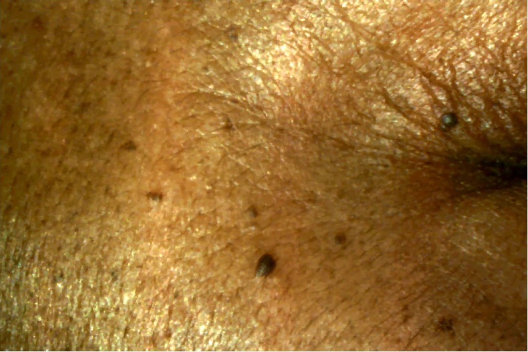 The Power of Revox™ Line Relaxer