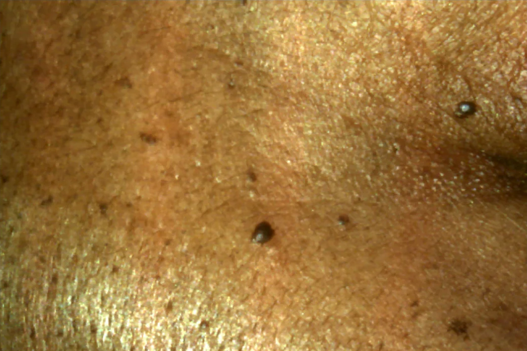 The Power of Revox™ Line Relaxer