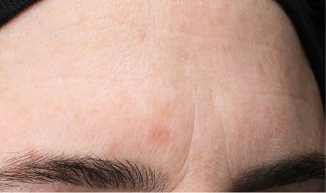 The Power of Revox™ Line Relaxer