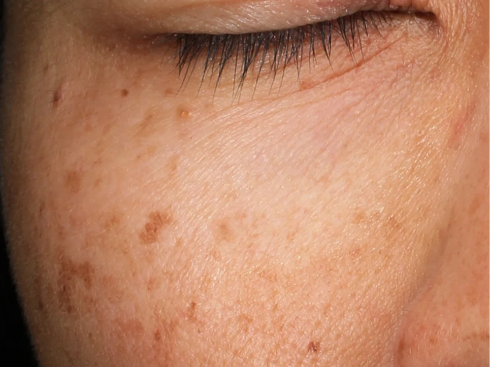 The Power of Revox™ Line Relaxer