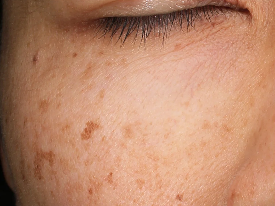 The Power of Revox™ Line Relaxer