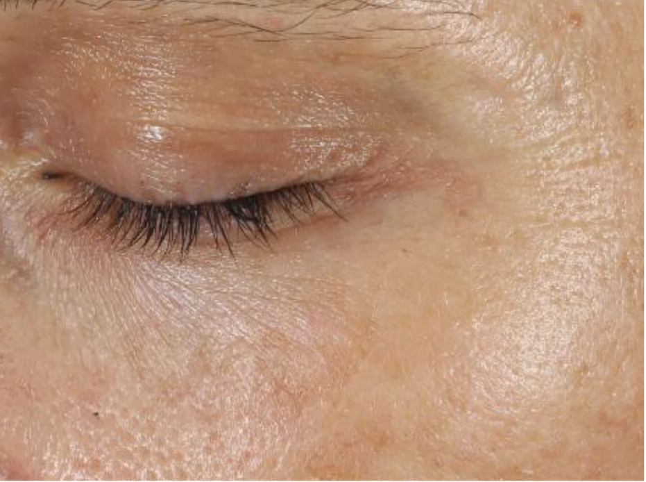 A comprehensive eye treatment inspired by the Dermal-Epidermal Junction(DEJ) that is clinically-proven to rejuvenate the total eye area