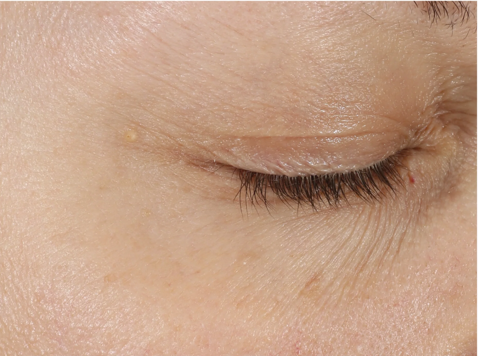 A comprehensive eye treatment inspired by the Dermal-Epidermal Junction(DEJ) that is clinically-proven to rejuvenate the total eye area