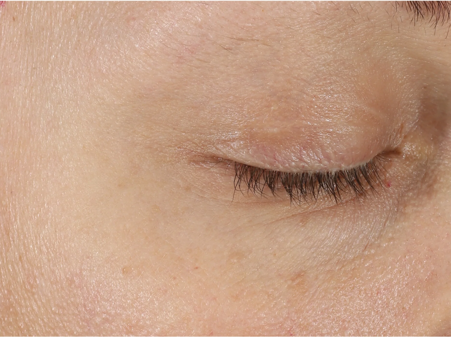 A comprehensive eye treatment inspired by the Dermal-Epidermal Junction(DEJ) that is clinically-proven to rejuvenate the total eye area