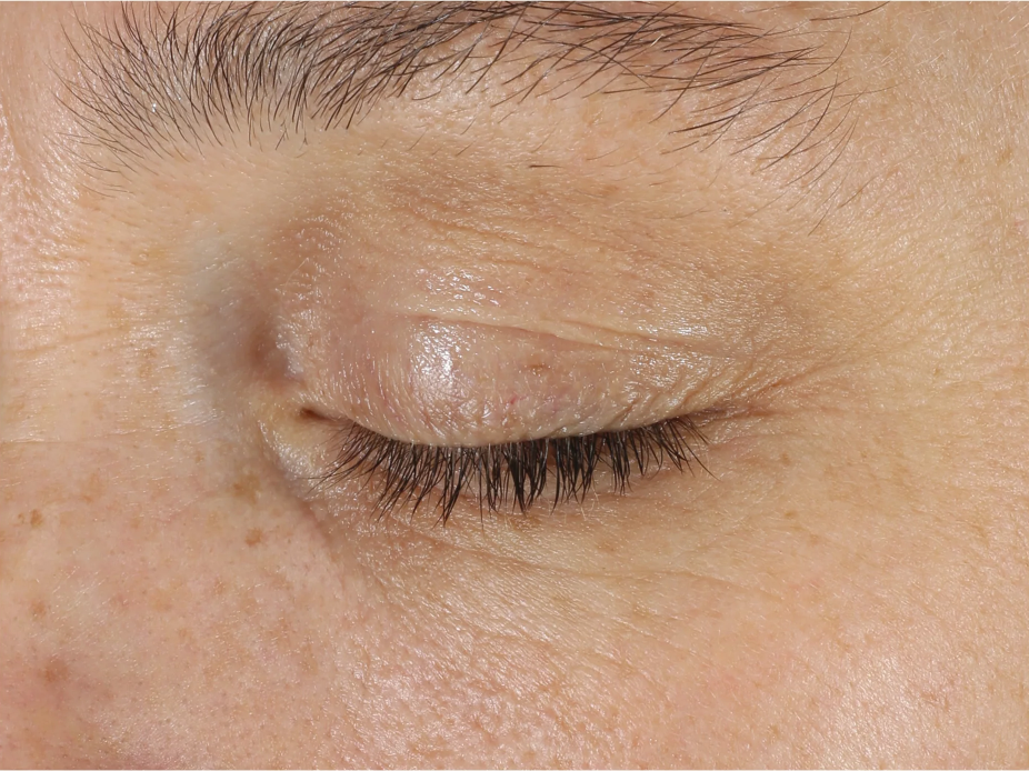 A comprehensive eye treatment inspired by the Dermal-Epidermal Junction(DEJ) that is clinically-proven to rejuvenate the total eye area