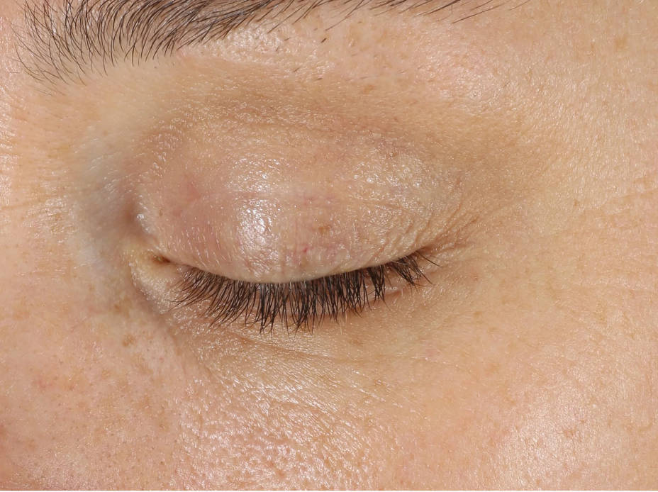 A comprehensive eye treatment inspired by the Dermal-Epidermal Junction(DEJ) that is clinically-proven to rejuvenate the total eye area