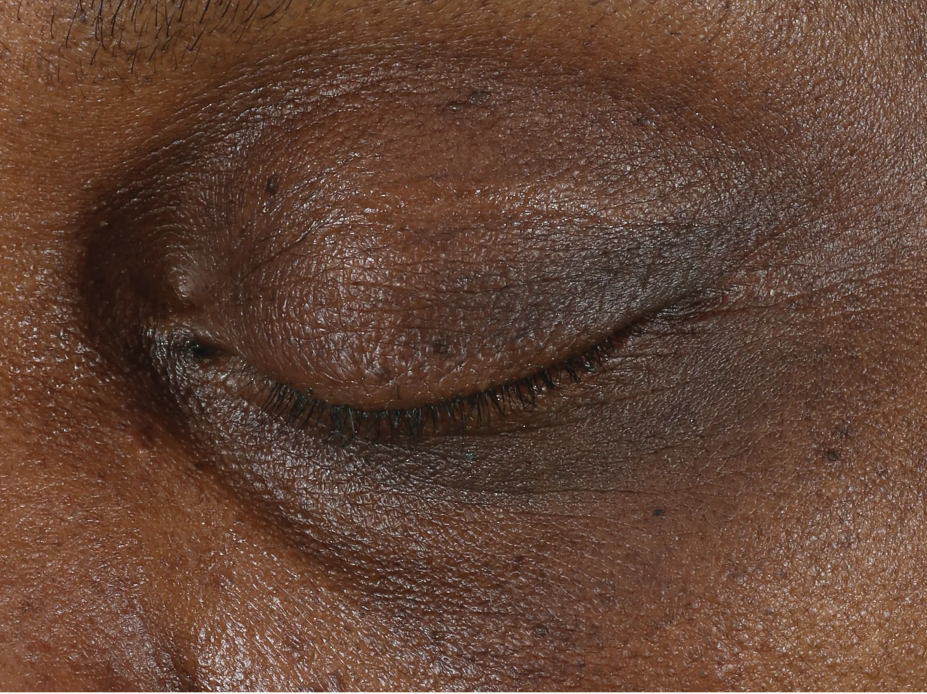 A comprehensive eye treatment inspired by the Dermal-Epidermal Junction(DEJ) that is clinically-proven to rejuvenate the total eye area