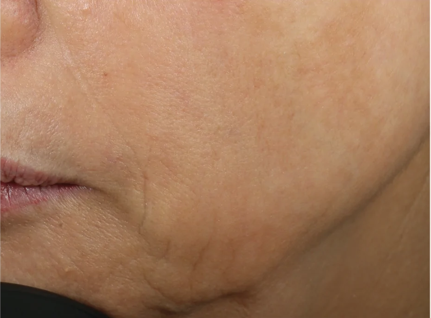 An advanced skin-renewing moisturizer that firms, lifts and smooths the skin utilizing a comprehensive, one-of-a-kind formula to deliver clinically-proven results