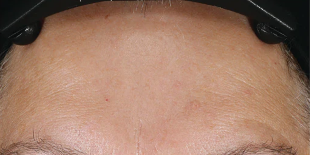 An advanced skin-renewing moisturizer that firms, lifts and smooths the skin utilizing a comprehensive, one-of-a-kind formula to deliver clinically-proven results