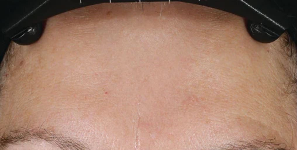 An advanced skin-renewing moisturizer that firms, lifts and smooths the skin utilizing a comprehensive, one-of-a-kind formula to deliver clinically-proven results