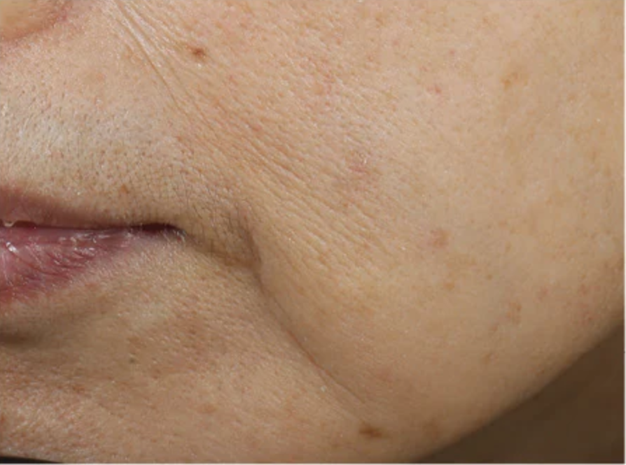 An advanced skin-renewing moisturizer that firms, lifts and smooths the skin utilizing a comprehensive, one-of-a-kind formula to deliver clinically-proven results