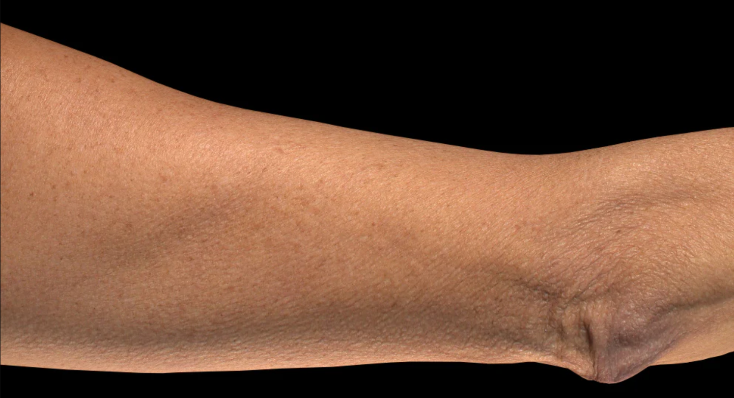 breakthrough body contouring lotion for firmer, more toned-looking skin