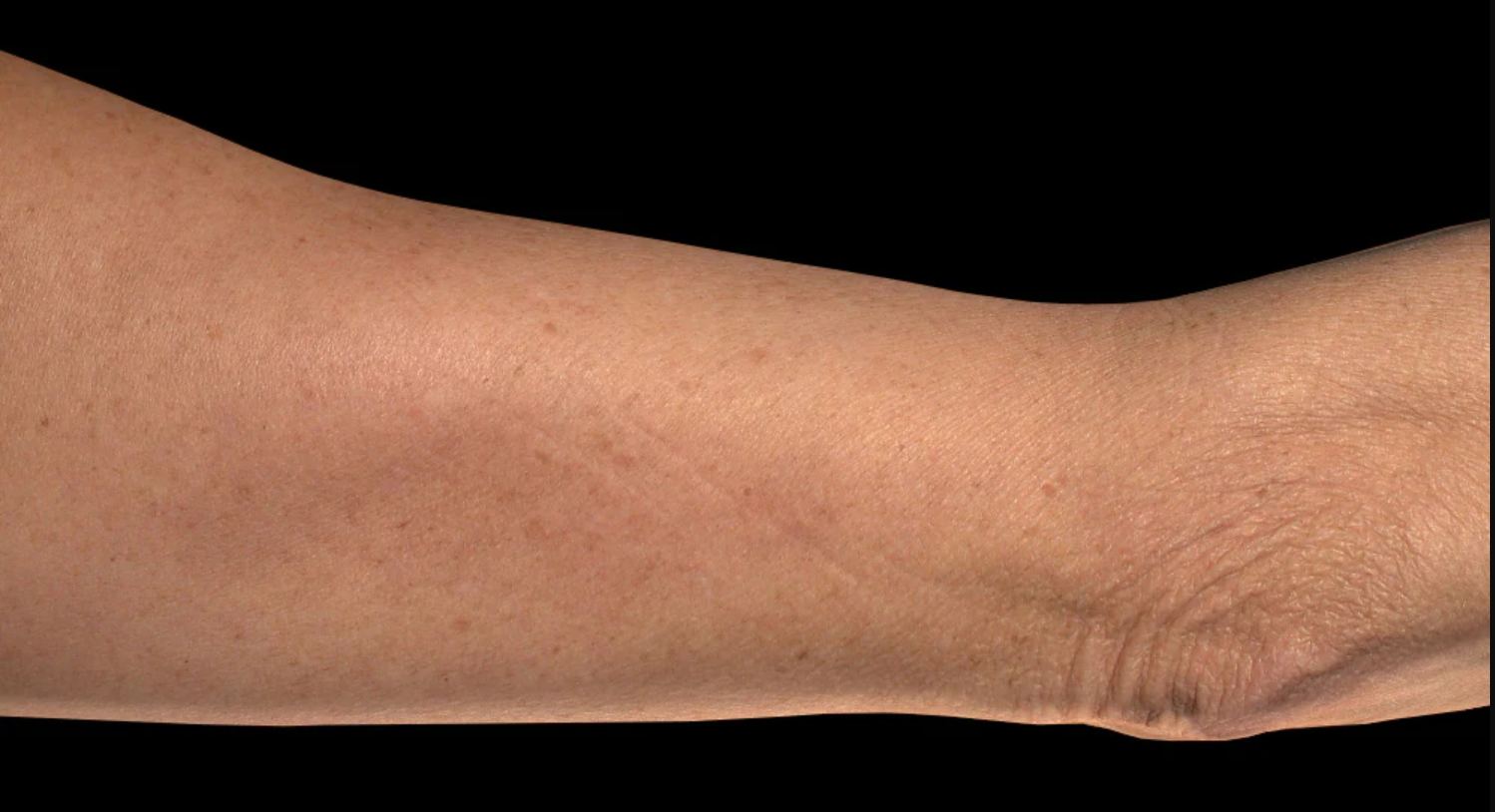 breakthrough body contouring lotion for firmer, more toned-looking skin