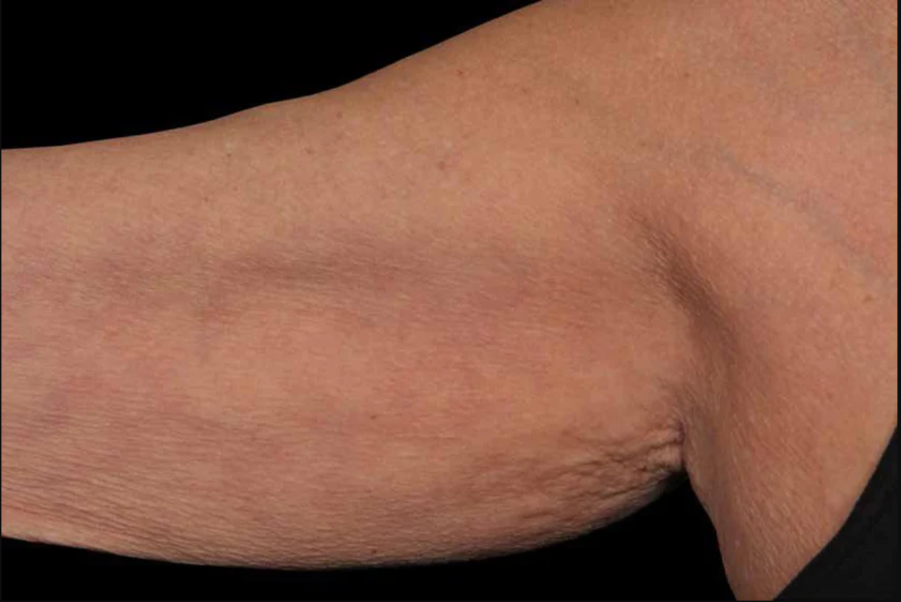 breakthrough body contouring lotion for firmer, more toned-looking skin