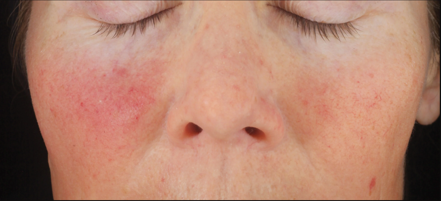 exclusive antioxidant blend with patent-pending MelaPATH™ technology