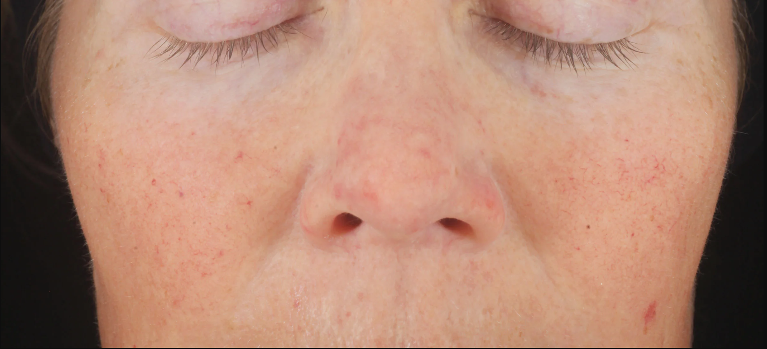 exclusive antioxidant blend with patent-pending MelaPATH™ technology