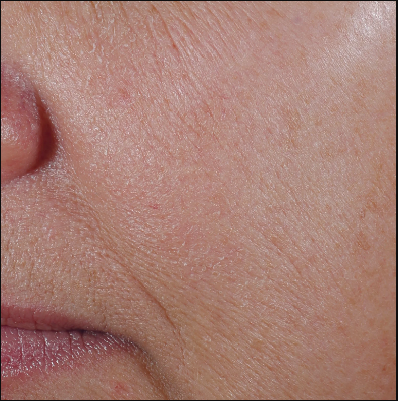 exclusive antioxidant blend with patent-pending MelaPATH™ technology