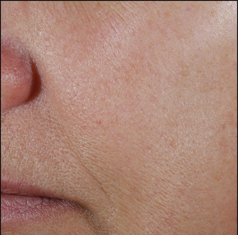 exclusive antioxidant blend with patent-pending MelaPATH™ technology