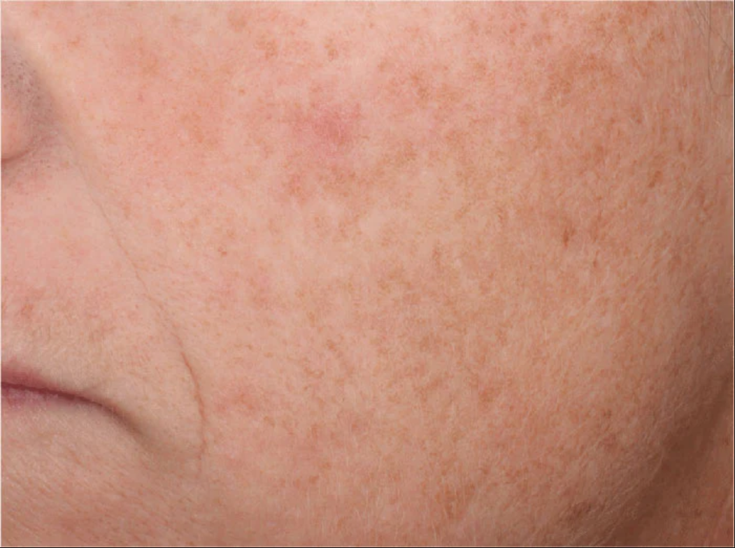 A 5-in-1 daily anti-aging tinted moisturizer with broad-spectrum SPF 45 that is formulated to correct, protect, conceal, brighten and hydrate skin