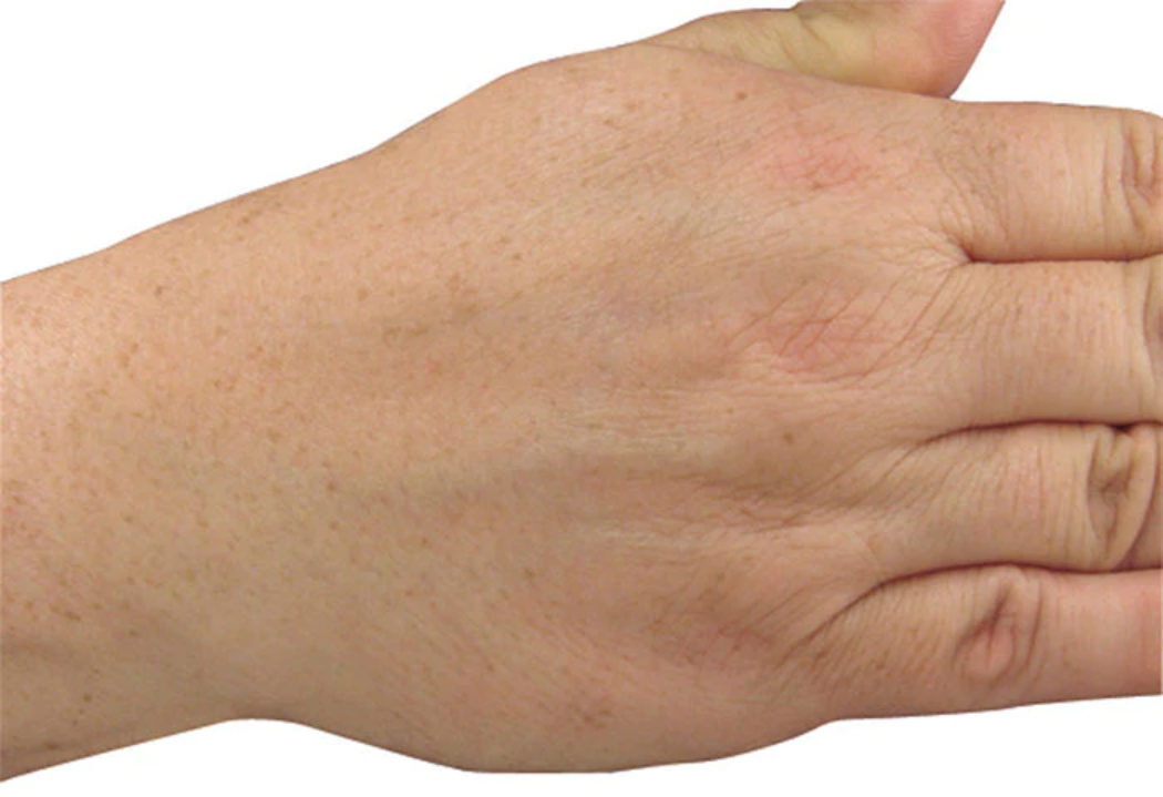 brightening treatment for younger looking hands