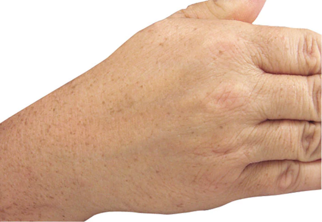 brightening treatment for younger looking hands