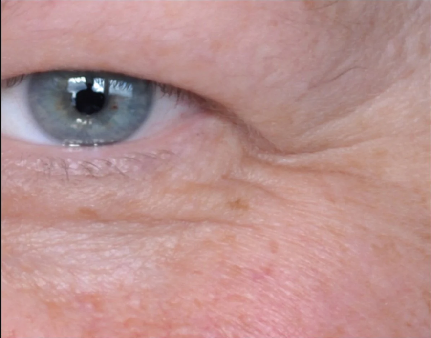 peptide-rich serum for expression lines