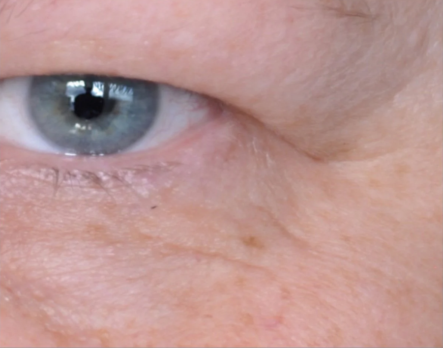 peptide-rich serum for expression lines