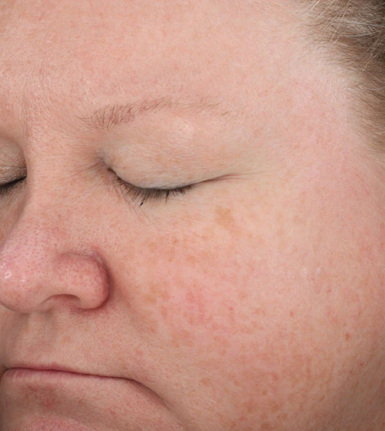 for reduced appearance of fine lines and wrinkles