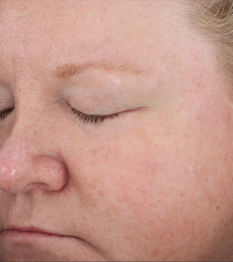 for reduced appearance of fine lines and wrinkles