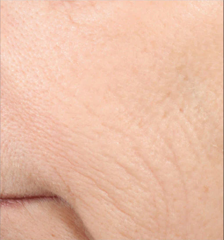 for reduced appearance of fine lines and wrinkles
