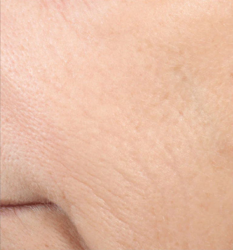 for reduced appearance of fine lines and wrinkles