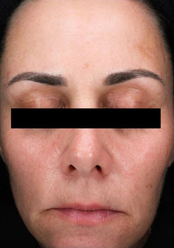 A powerhouse serum formulated with patent-pending Sunflower Sprout Extract Technology that has been clinically proven to impact the visible effects of glycation on skin