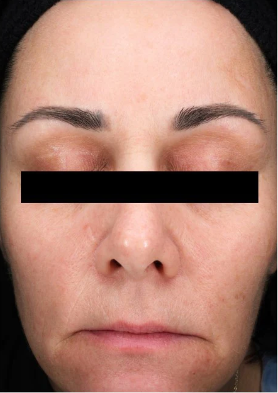 A powerhouse serum formulated with patent-pending Sunflower Sprout Extract Technology that has been clinically proven to impact the visible effects of glycation on skin