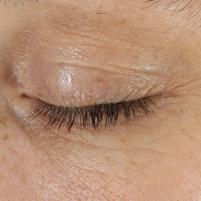D·E·J Eye Cream®Before