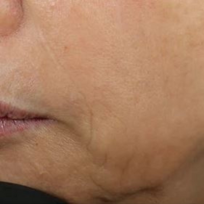 DEJ Face Cream® After