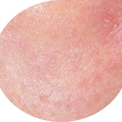 Case 2 After