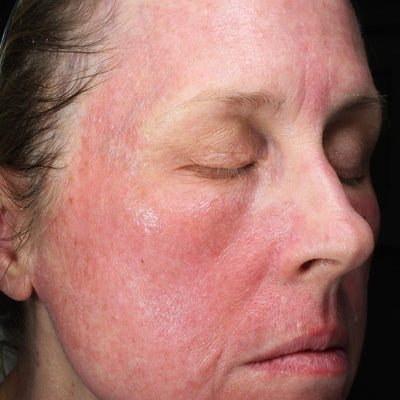 Case 1Before