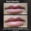 YouthFull Lip Replenisher™ -the definitive solution for youthful lips
