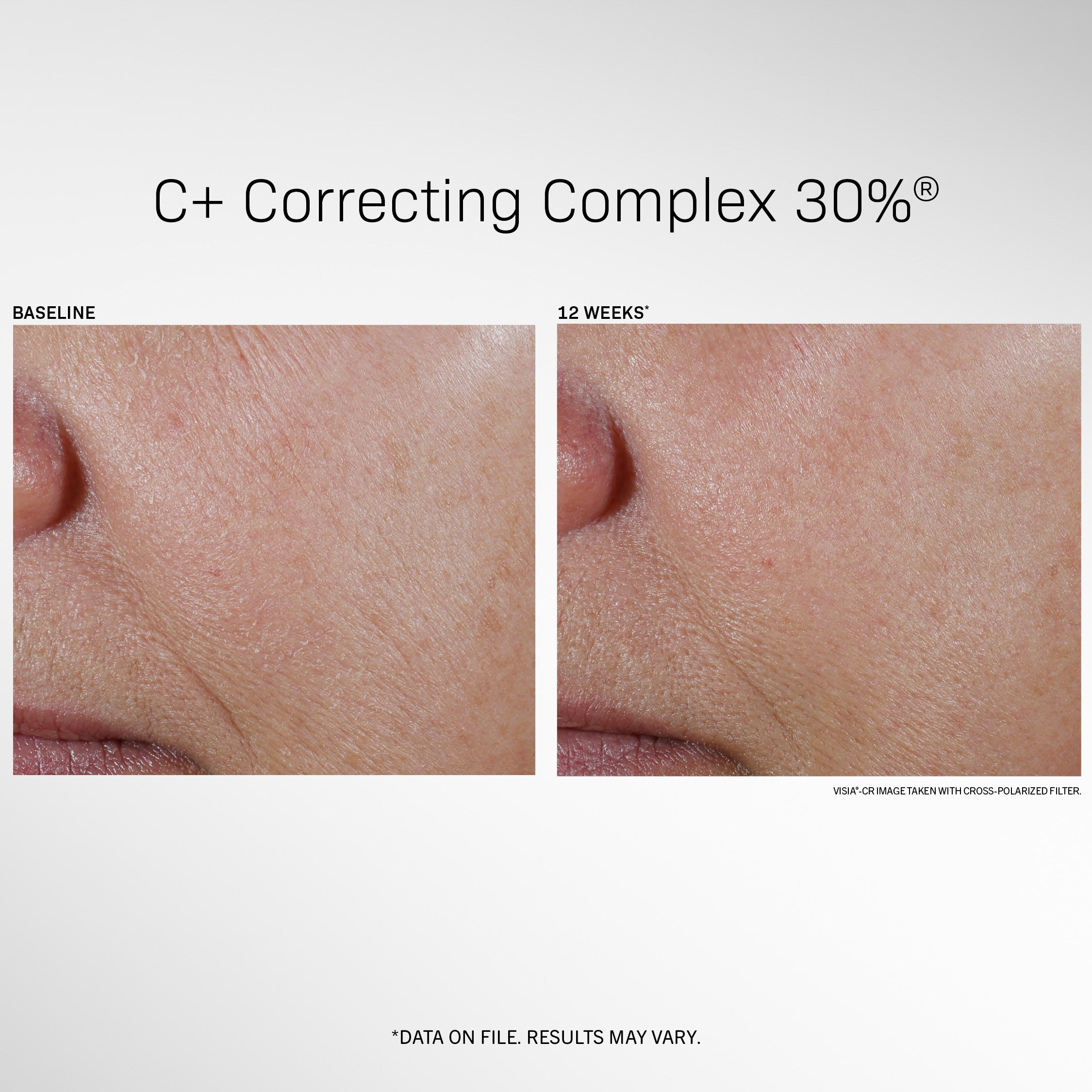 C+ Correcting Complex 30%™ | Revision Skincare®