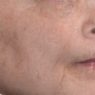 Close-up of a persons cheek, mouth, and part of their nose, showing skin texture and fine lines. The image focuses on the lower half of the face.
