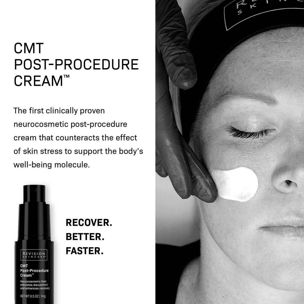 A gloved hand applies Revision Skincare’s CMT Post-Procedure Cream™ to a woman’s face with a cotton pad. The text highlights its neurocosmetic technology for post-procedure recovery and reduced downtime, alongside an image of the black bottle.