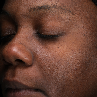 A close-up of a persons face with medium to deep brown skin, showing closed eyes, a relaxed expression, and visible skin texture with pores, fine lines, and a few small moles.
