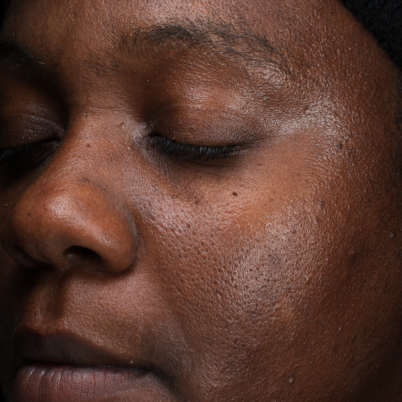 Before & After: D·E·J Daily Boosting Serum® | Revision Skincare®