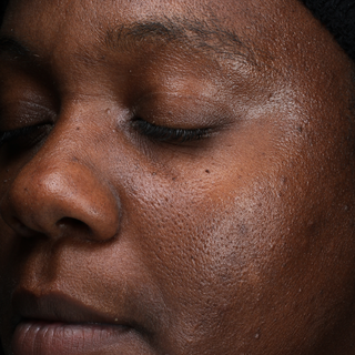 Close-up of a persons face with eyes closed, showing smooth, dark skin and visible pores. The lighting highlights the texture and natural appearance of the skin.